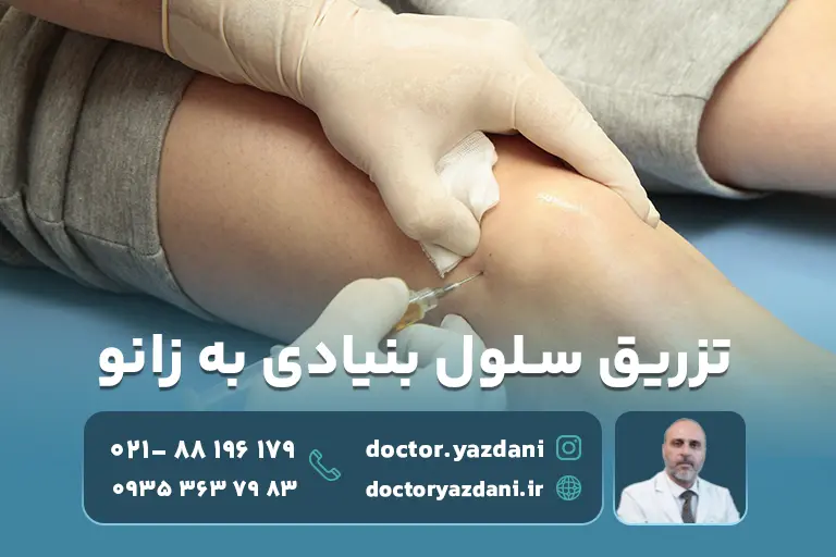 چگونگی تزریق سلول بنیادی به زانو